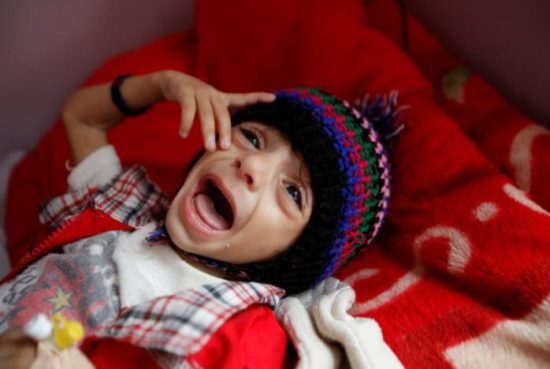 EnA boy cries at a hospital malnutrition intensive care unit in Sanaa, Yemen September 26, 2016. REUTERS/Khaled Abdullah